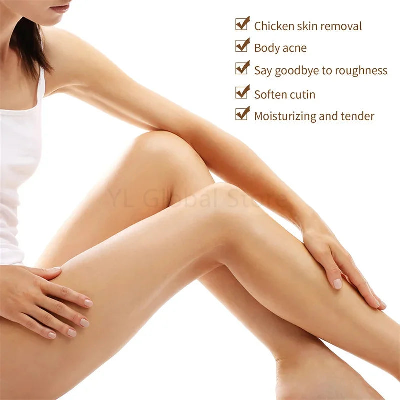 Fruit Acid VE Urea Cream Improve Chicken Skin Keratosis Pilaris Hydrating Moisturizing Rejuvenating Body Lotion Leg Arm Dry Skin