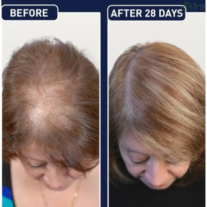 50mL FEG hair growth spray precent hair loss stimulate hair focile growth ownning Longer, thicker and healthier hair