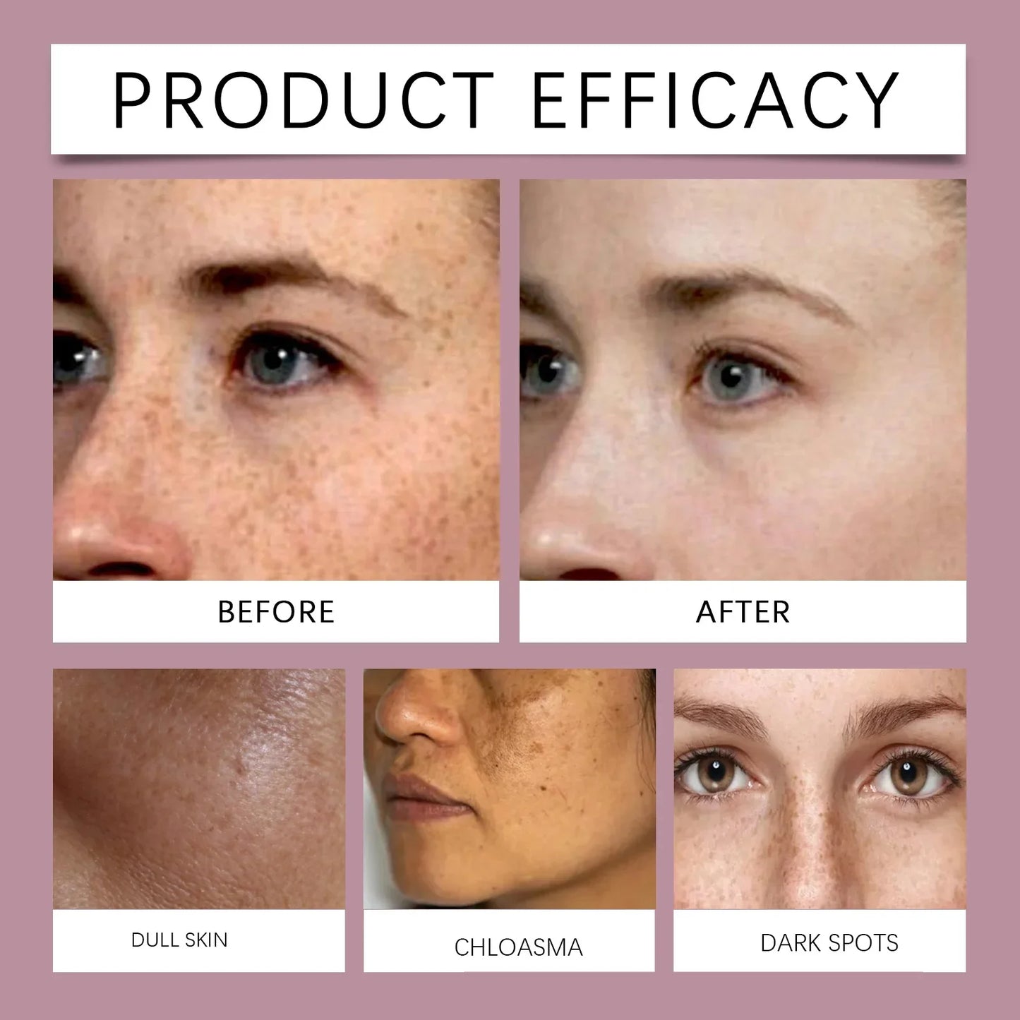 Powerful Spot-Removing Whiten Cream Brighten Skin Fast Eliminates Melanin Pigmentation Melasma Dark Spots Korean Skin Care 20g
