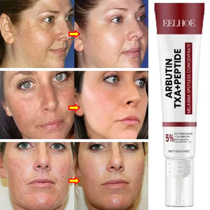 Powerful Spot-Removing Whiten Cream Brighten Skin Fast Eliminates Melanin Pigmentation Melasma Dark Spots Korean Skin Care 20g