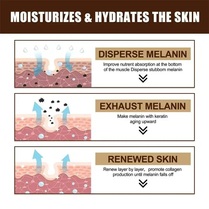 Powerful Spot-Removing Whiten Cream Brighten Skin Fast Eliminates Melanin Pigmentation Melasma Dark Spots Korean Skin Care 20g