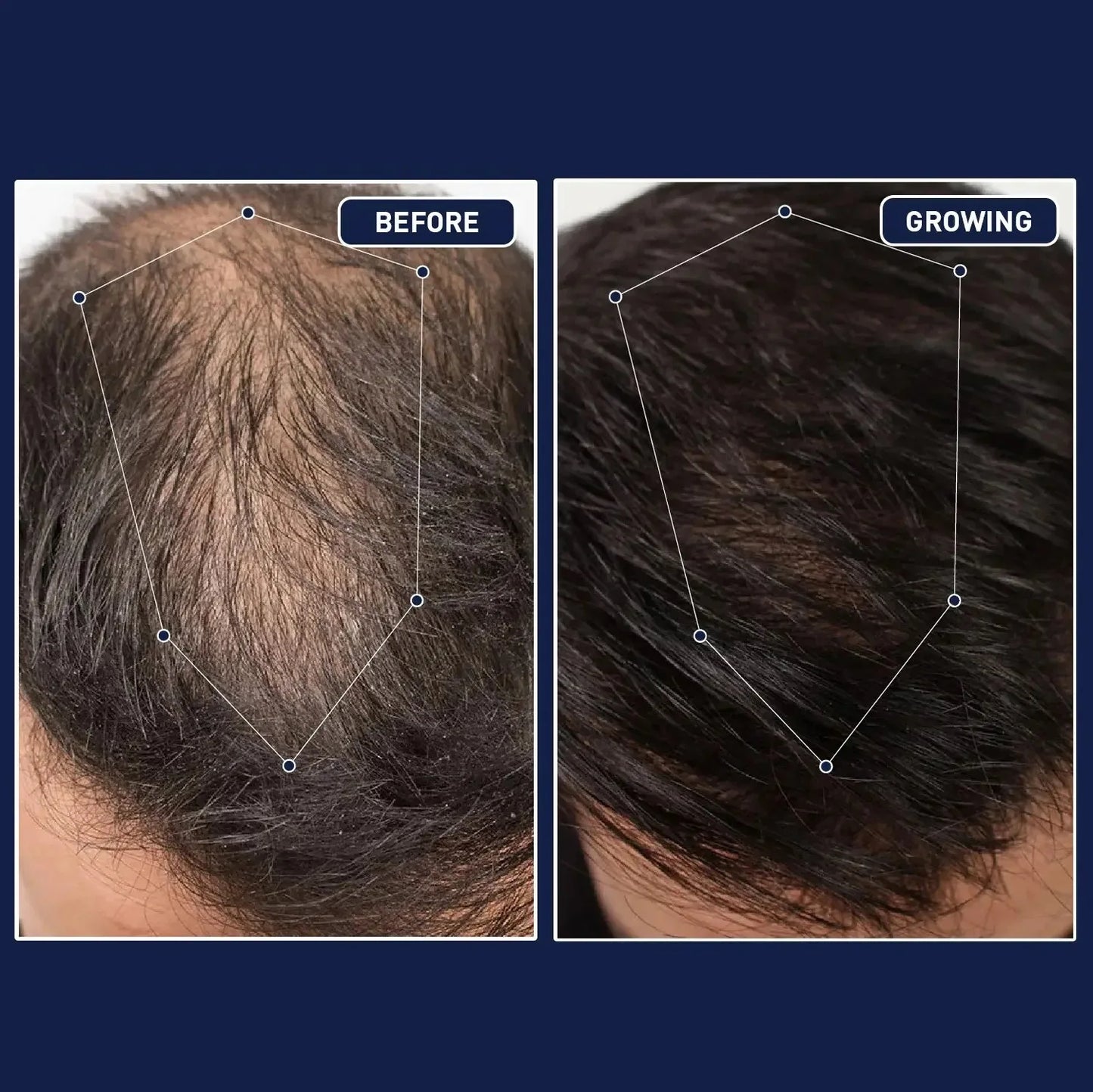 50mL FEG hair growth spray precent hair loss stimulate hair focile growth ownning Longer, thicker and healthier hair