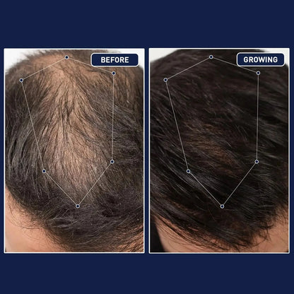 50mL FEG hair growth spray precent hair loss stimulate hair focile growth ownning Longer, thicker and healthier hair