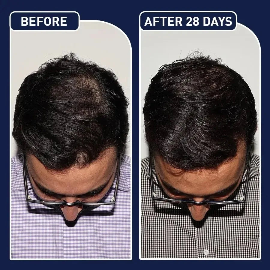 50mL FEG hair growth spray precent hair loss stimulate hair focile growth ownning Longer, thicker and healthier hair