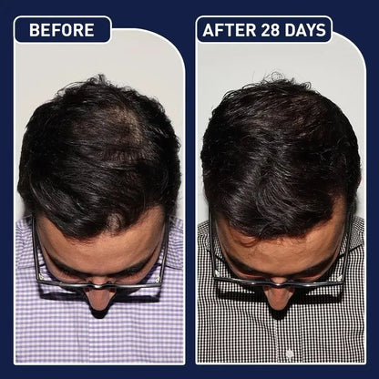 50mL FEG hair growth spray precent hair loss stimulate hair focile growth ownning Longer, thicker and healthier hair