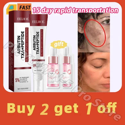 Powerful Spot-Removing Whiten Cream Brighten Skin Fast Eliminates Melanin Pigmentation Melasma Dark Spots Korean Skin Care 20g